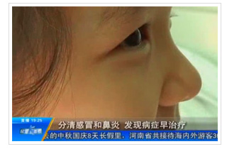 河南电视台民生频道：分清感冒和鼻炎，发现病症早治疗