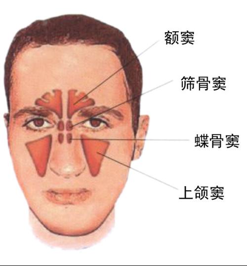 小孩的慢性鼻炎如何治