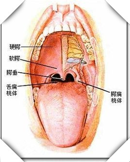 腭扁桃体与扁桃体是一样的吗，发炎了怎么治？