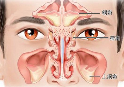 预防鼻窦炎有哪些方法？